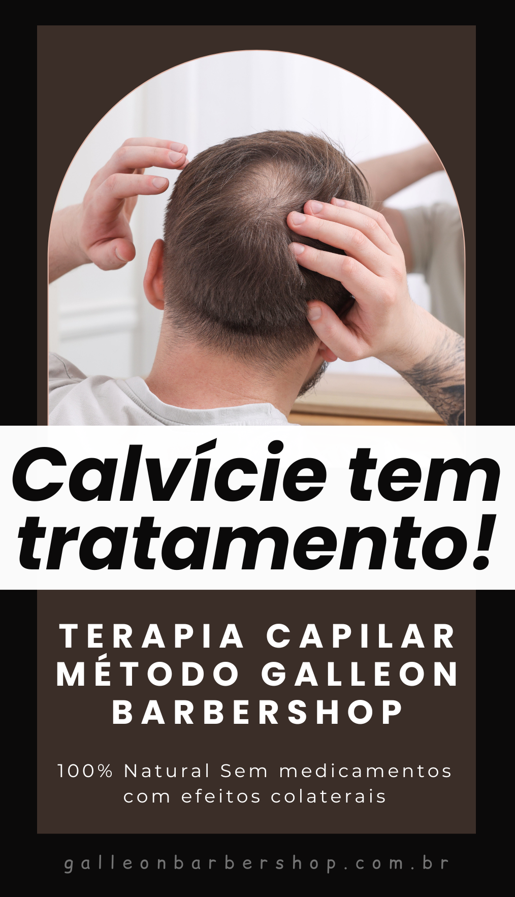 Tratamento calvície